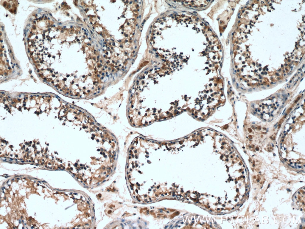 Immunohistochemistry (IHC) staining of human testis tissue using TSGA10 Polyclonal antibody (12593-1-AP)