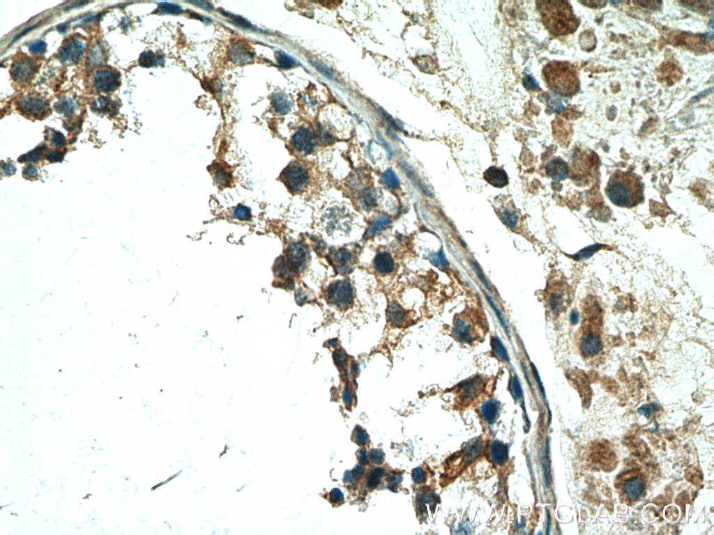 Immunohistochemistry (IHC) staining of human testis tissue using TSGA10 Polyclonal antibody (12593-1-AP)