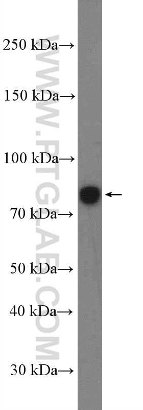 Western Blot (WB) analysis of rat testis tissue using TSGA10 Polyclonal antibody (12593-1-AP)