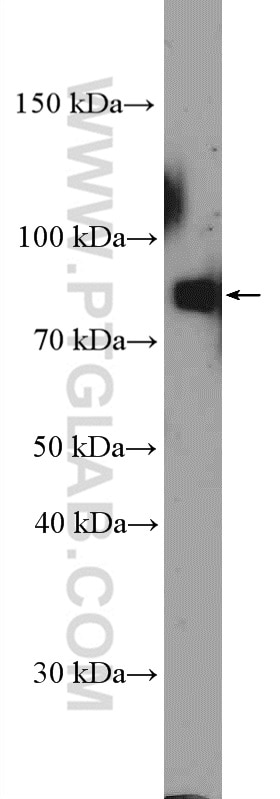 Western Blot (WB) analysis of rat testis tissue using TSGA10 Polyclonal antibody (12593-1-AP)