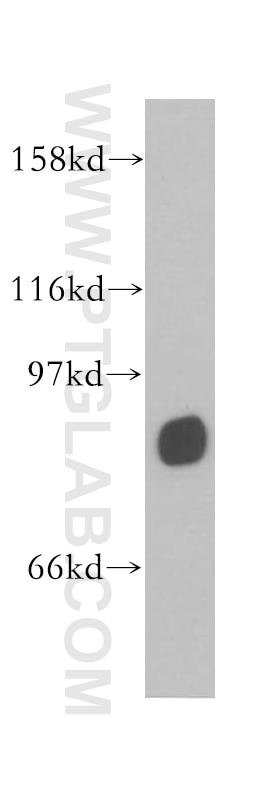Western Blot (WB) analysis of mouse testis tissue using TSGA10 Polyclonal antibody (12593-1-AP)