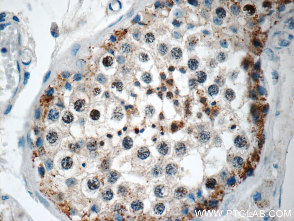 IHC staining of human testis using 17326-1-AP (same clone as 17326-1-PBS) Immunohistochemistry (IHC) staining of human testis tissue using TSGA13 Polyclonal antibody (17326-1-AP)