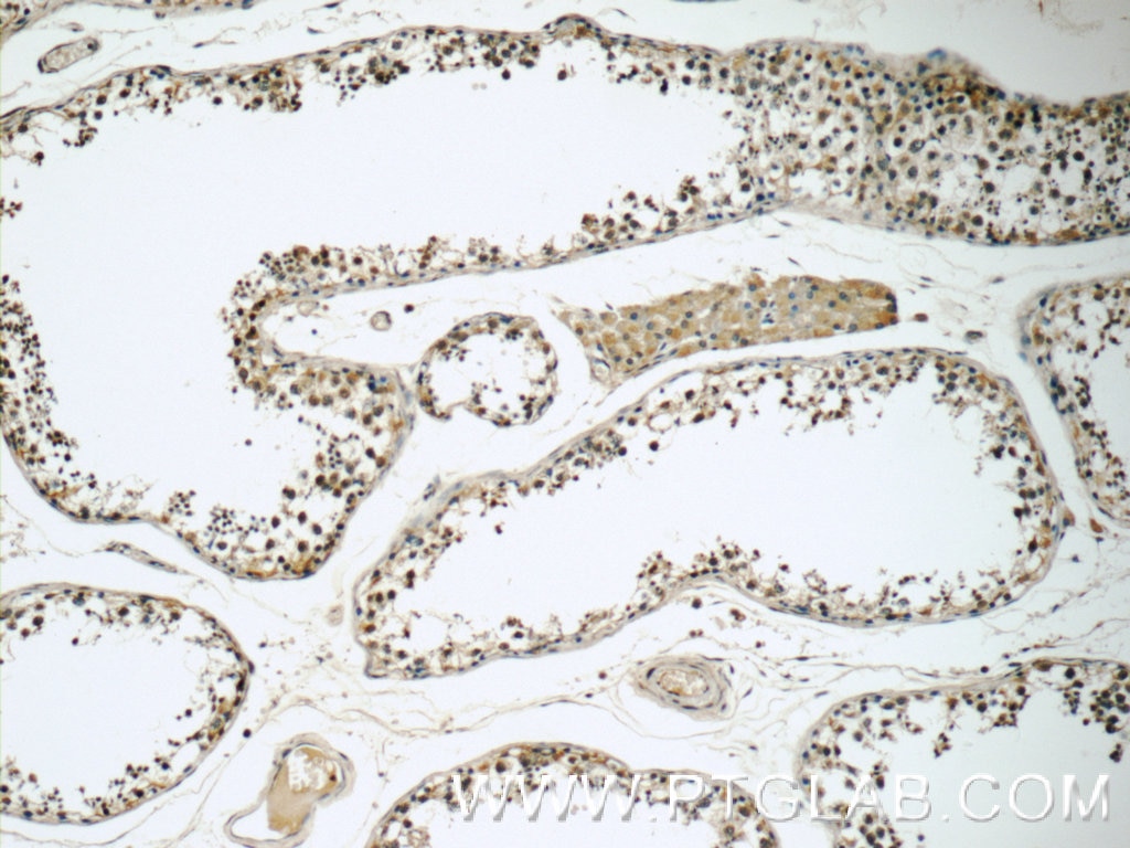 Immunohistochemistry (IHC) staining of human testis tissue using TSGA14 Polyclonal antibody (17566-1-AP)