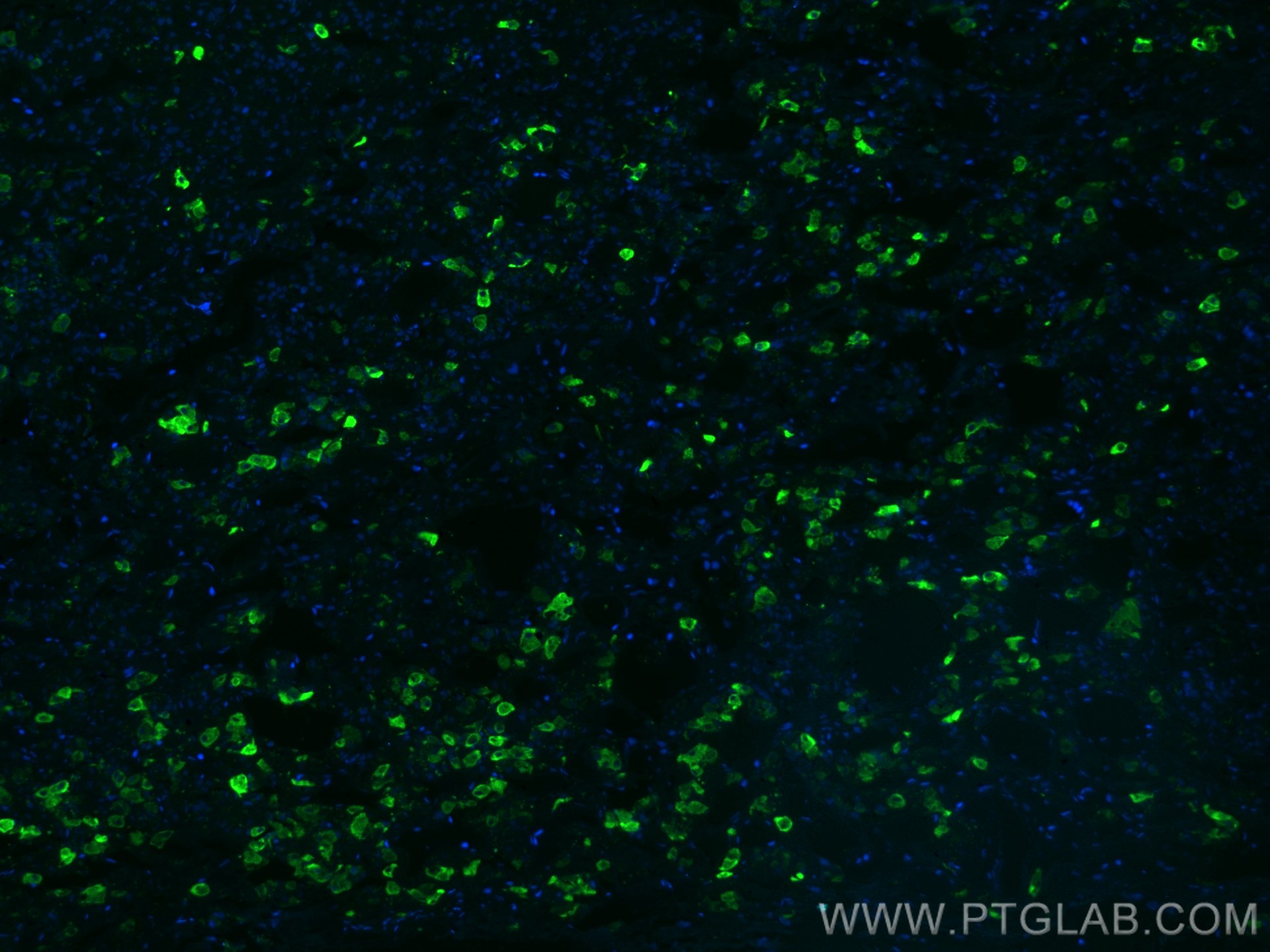 Immunofluorescence (IF) / fluorescent staining of human pituitary tissue using CoraLite® Plus 488-conjugated TSH Beta Monoclonal  (CL488-66750)