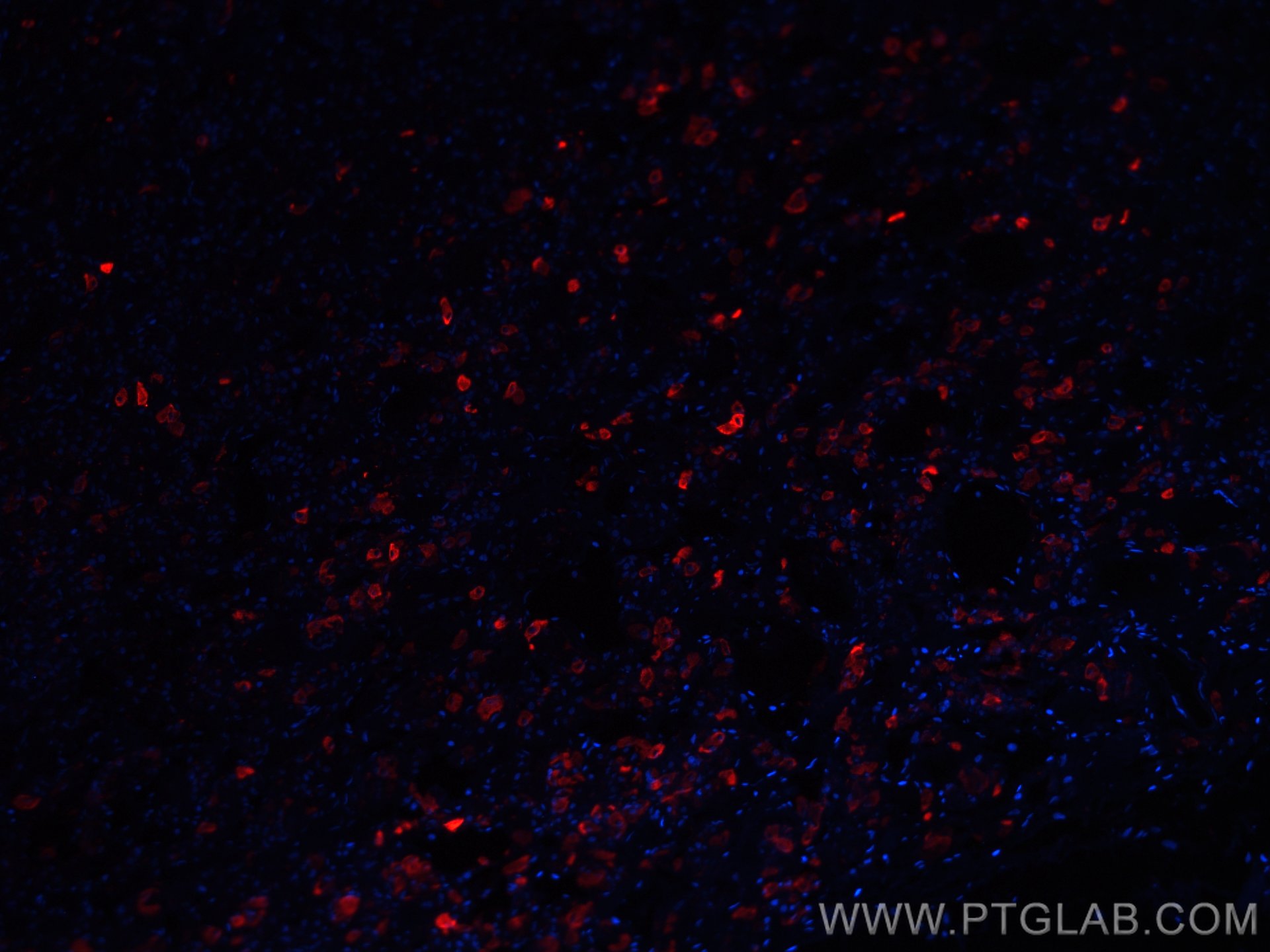 Immunofluorescence (IF) / fluorescent staining of human pituitary tissue using CoraLite®594-conjugated TSH Beta Monoclonal antibo (CL594-66750)
