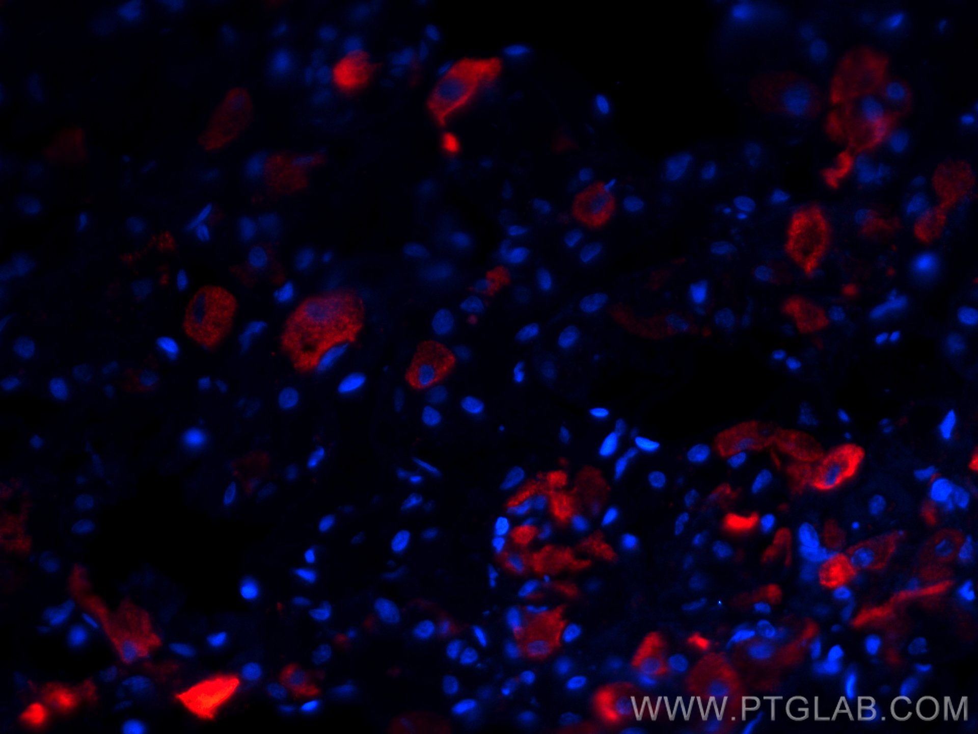IF Staining of human pituitary using CL594-66750
