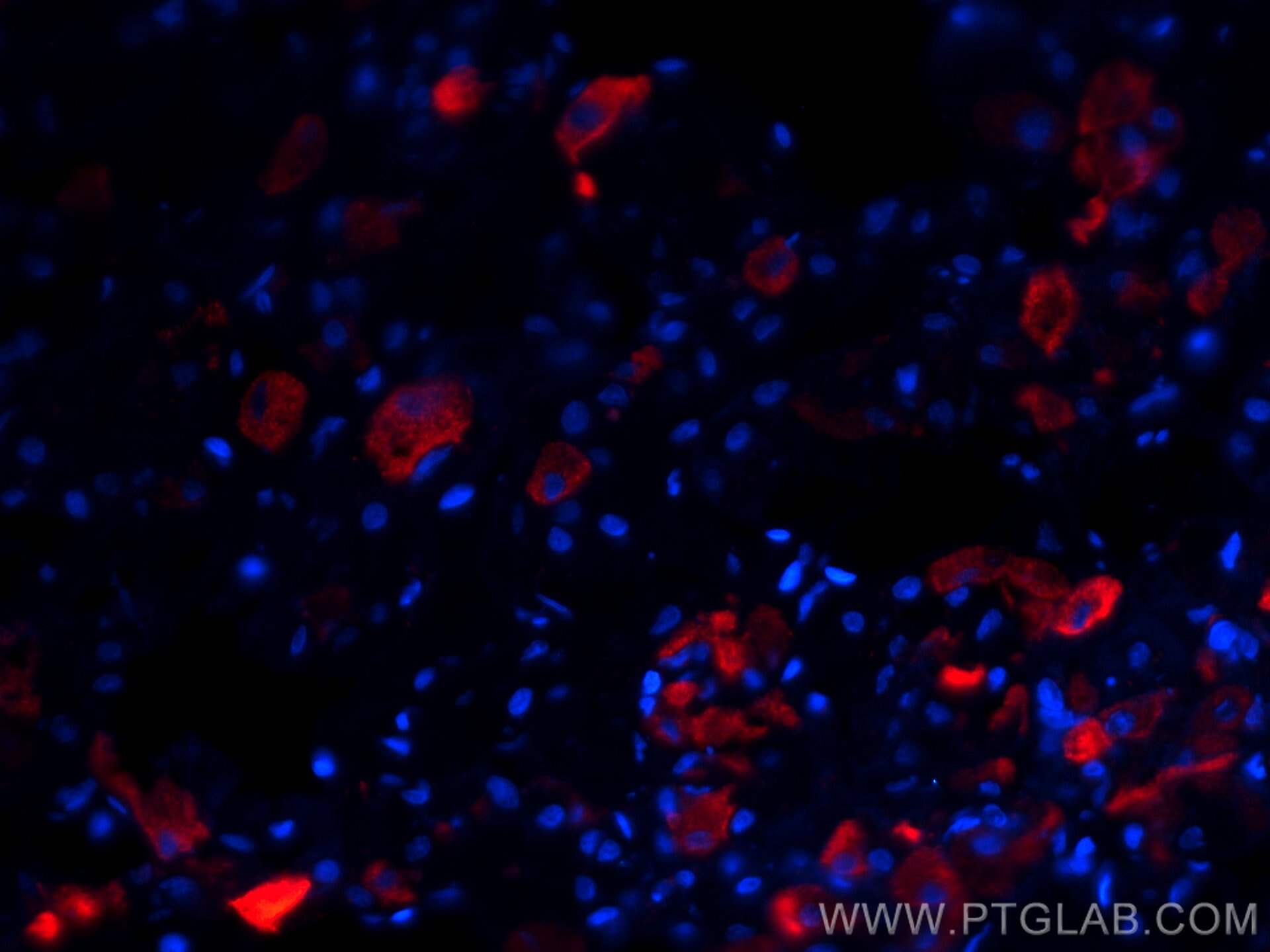 Immunofluorescence (IF) / fluorescent staining of human pituitary tissue using CoraLite®594-conjugated TSH Beta Monoclonal antibo (CL594-66750)