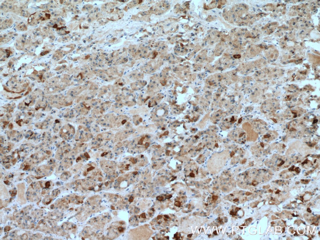 Immunohistochemistry (IHC) staining of human pituitary tissue using TSH Beta Polyclonal antibody (27288-1-AP)