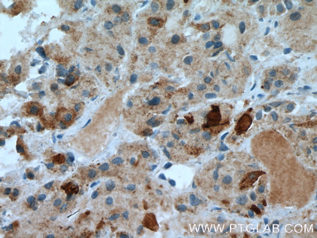 Immunohistochemistry (IHC) staining of human pituitary tissue using TSH Beta Polyclonal antibody (27288-1-AP)