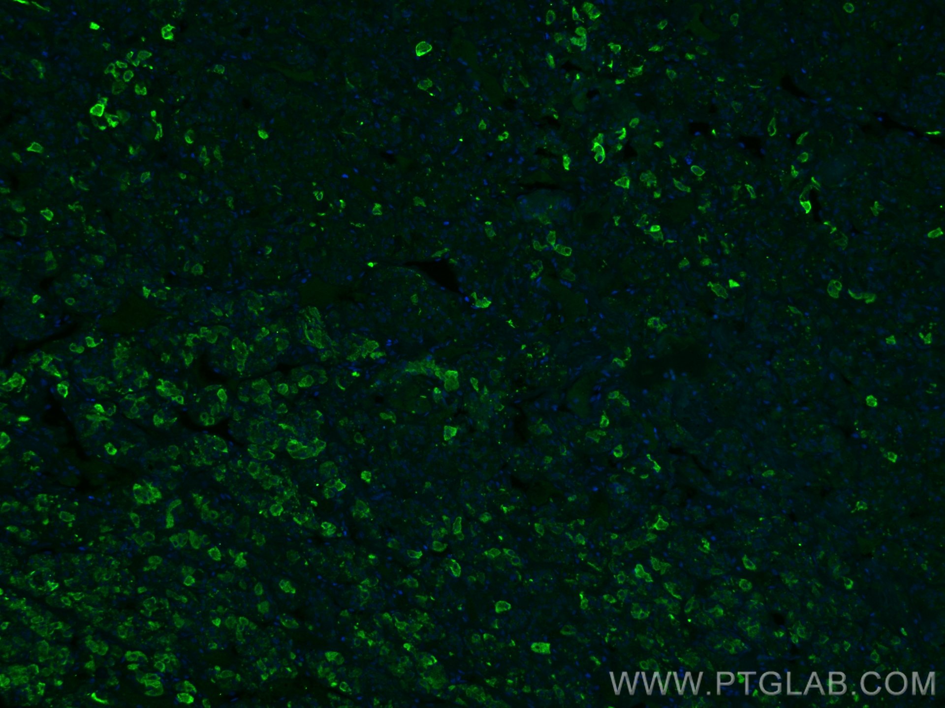 Immunofluorescence (IF) / fluorescent staining of human pituitary tissue using TSH Beta Monoclonal antibody (66750-1-Ig)
