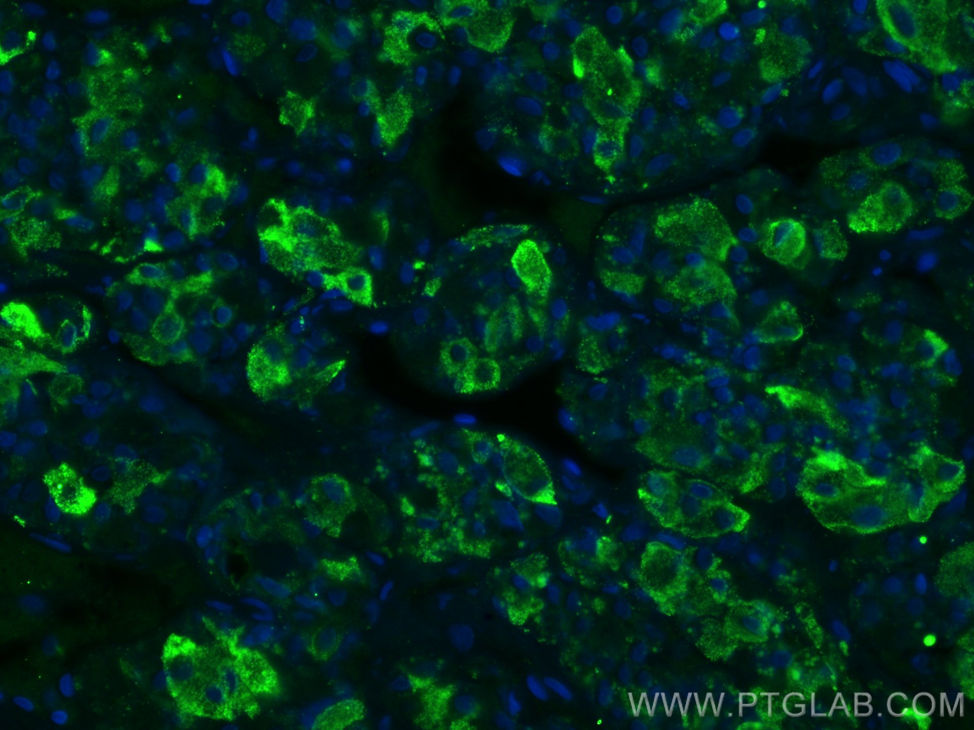 Immunofluorescence (IF) / fluorescent staining of human pituitary tissue using TSH Beta Monoclonal antibody (66750-1-Ig)