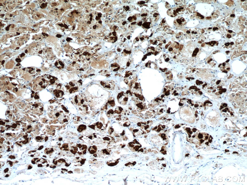 Immunohistochemistry (IHC) staining of human pituitary tissue using TSH Beta Monoclonal antibody (66750-1-Ig)