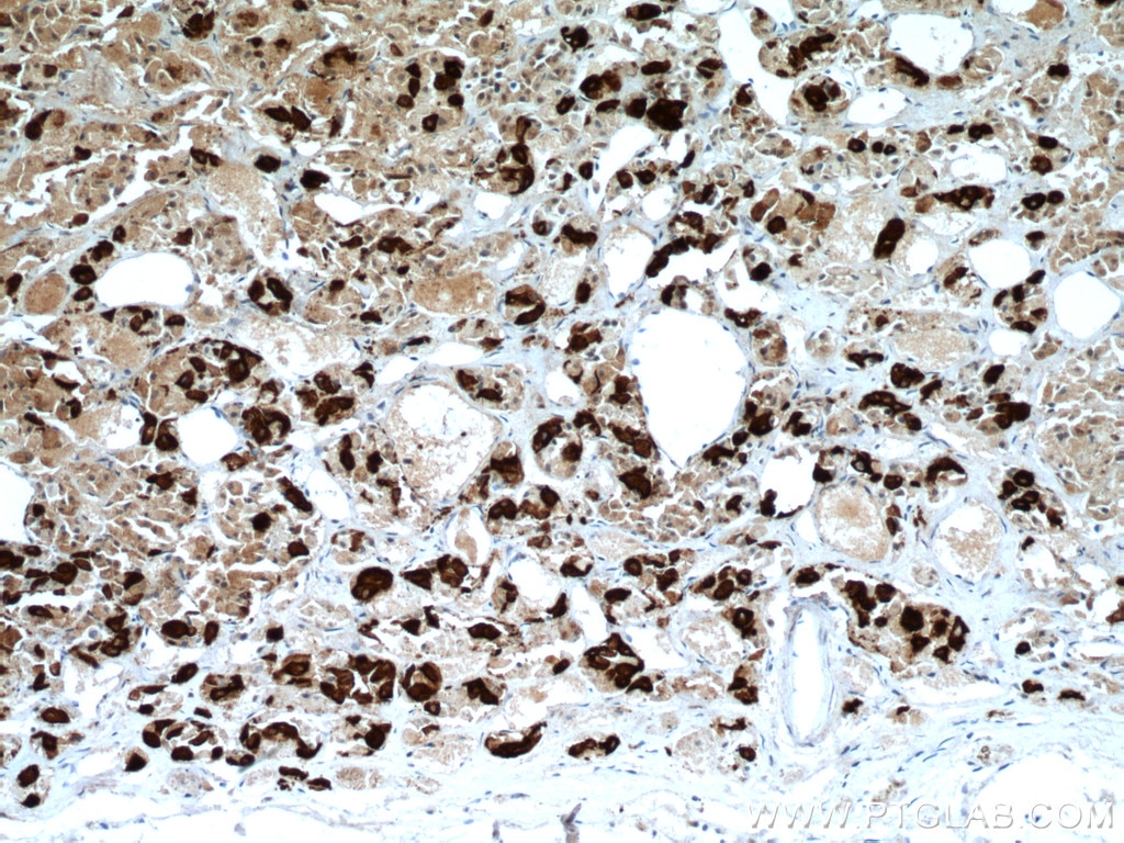 IHC staining of human pituitary using 66750-1-Ig