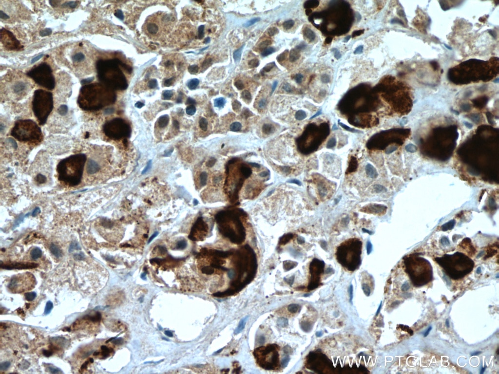 Immunohistochemistry (IHC) staining of human pituitary tissue using TSH Beta Monoclonal antibody (66750-1-Ig)