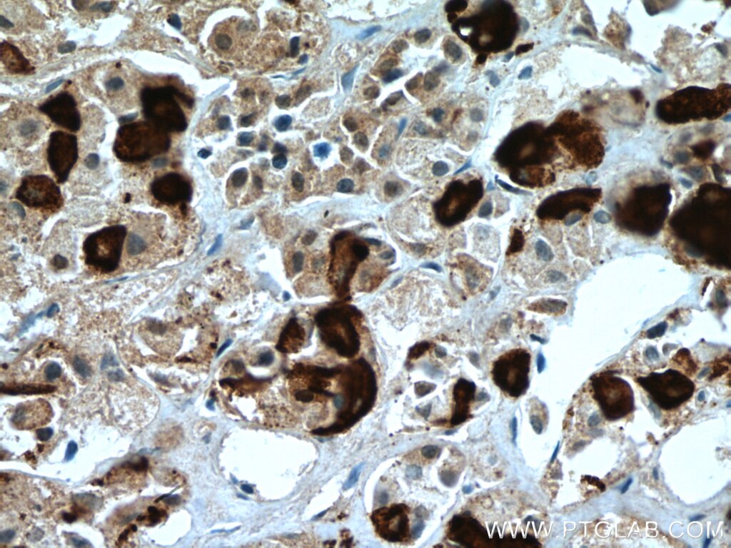 IHC staining of human pituitary using 66750-1-Ig