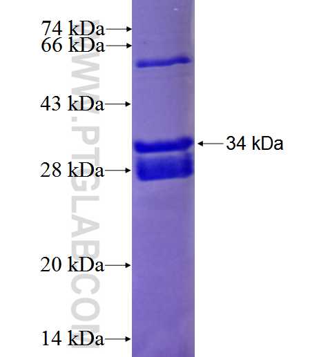 TSHB fusion protein Ag25532 SDS-PAGE