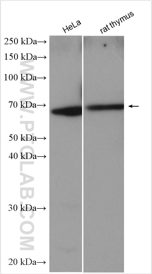Western Blot (WB) analysis of various lysates using TSHR Polyclonal antibody (14450-1-AP)