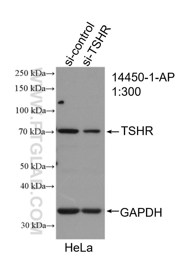 Western Blot (WB) analysis of HeLa cells using TSHR Polyclonal antibody (14450-1-AP)