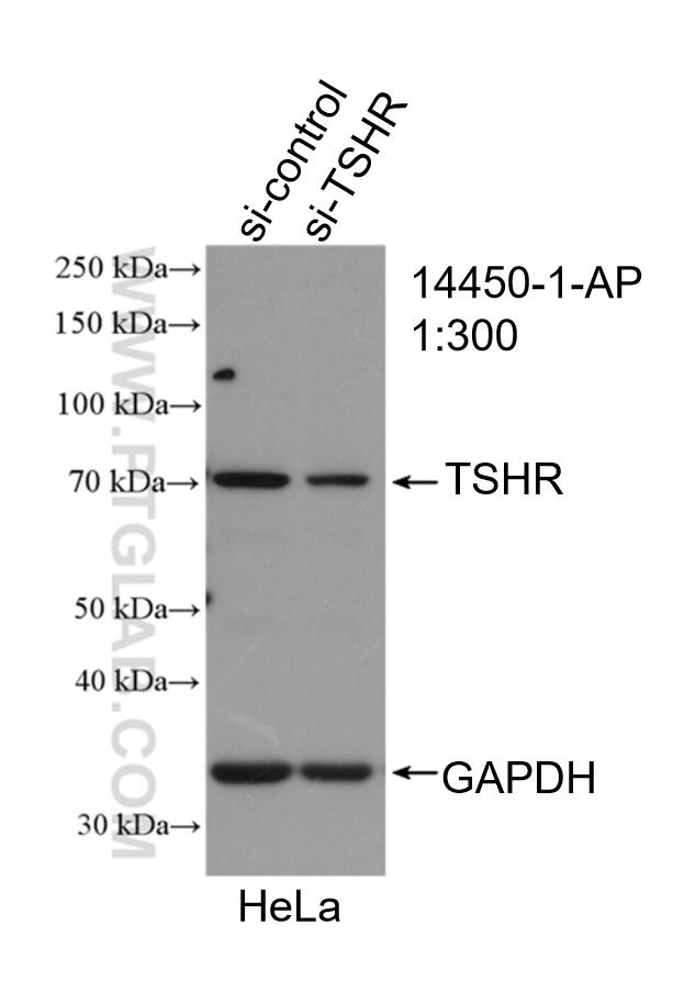 WB analysis of HeLa using 14450-1-AP