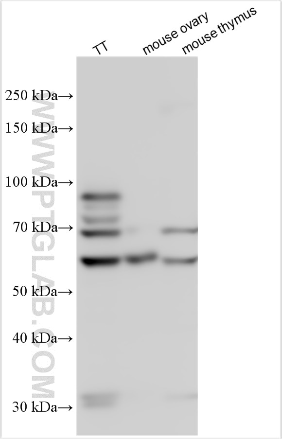 Western Blot (WB) analysis of various lysates using TSHR Polyclonal antibody (14450-1-AP)