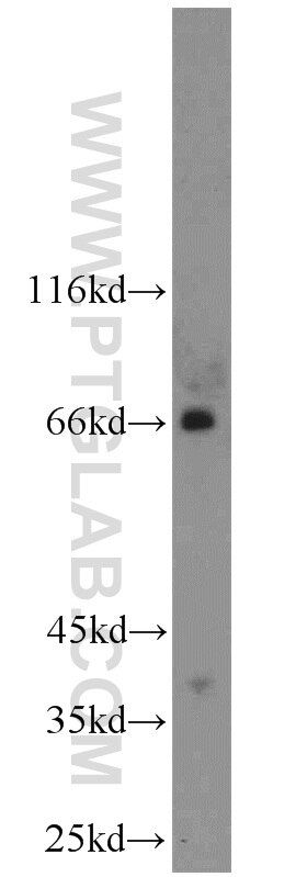 TSHR Polyclonal antibody