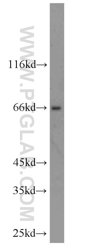 Western Blot (WB) analysis of mouse thymus tissue using TSHR Polyclonal antibody (14450-1-AP)