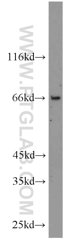 Western Blot (WB) analysis of mouse ovary tissue using TSHR Polyclonal antibody (14450-1-AP)