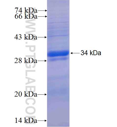TSHR fusion protein Ag6080 SDS-PAGE TSHR fusion protein Ag6080 SDS-PAGE