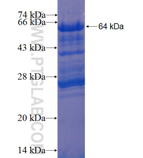 TSHZ1 fusion protein Ag2098 SDS-PAGE