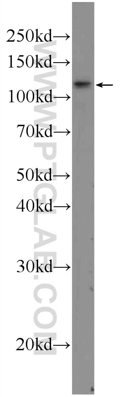 Western Blot (WB) analysis of mouse uterus tissue using TSHZ3 Polyclonal antibody (25018-1-AP)