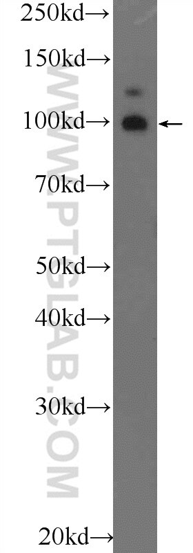 Western Blot (WB) analysis of mouse brain tissue using TSHZ3 Polyclonal antibody (25018-1-AP)