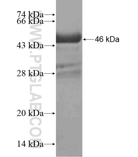 TSHZ3 fusion protein Ag18953 SDS-PAGE