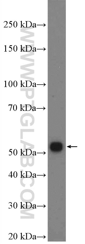 Western Blot (WB) analysis of mouse pancreas tissue using TSKU Polyclonal antibody (12370-1-AP)
