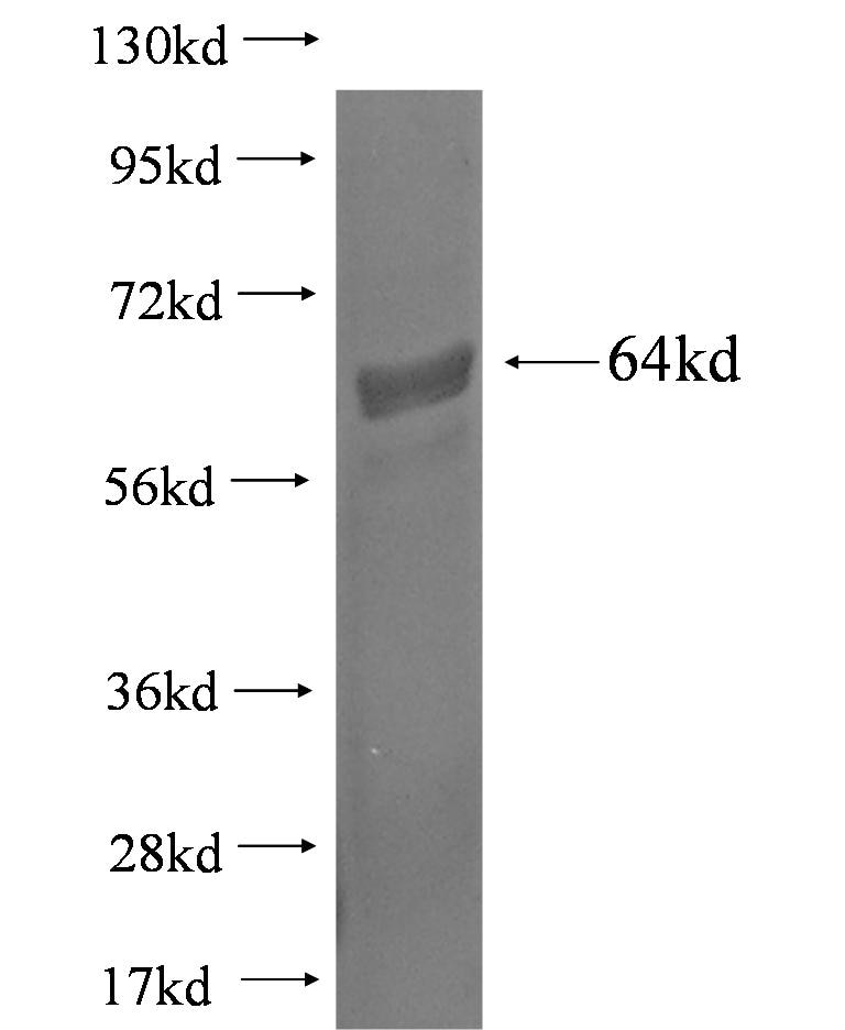TSKU fusion protein Ag3054 SDS-PAGE