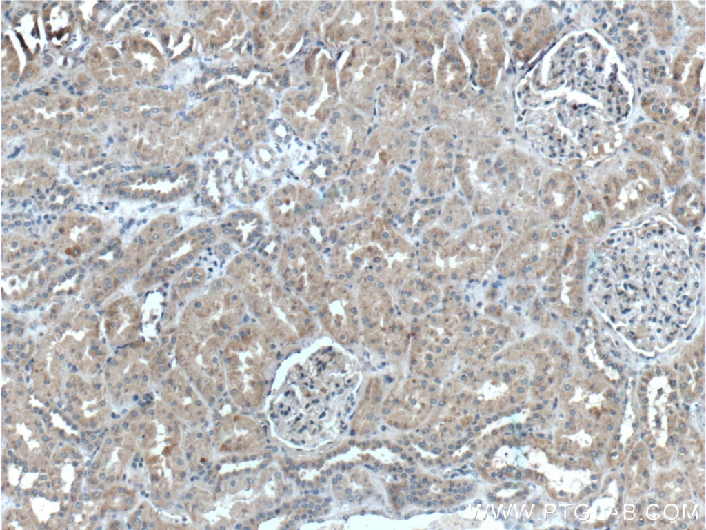 Immunohistochemistry (IHC) staining of human kidney tissue using TSLP Polyclonal antibody (13778-1-AP)