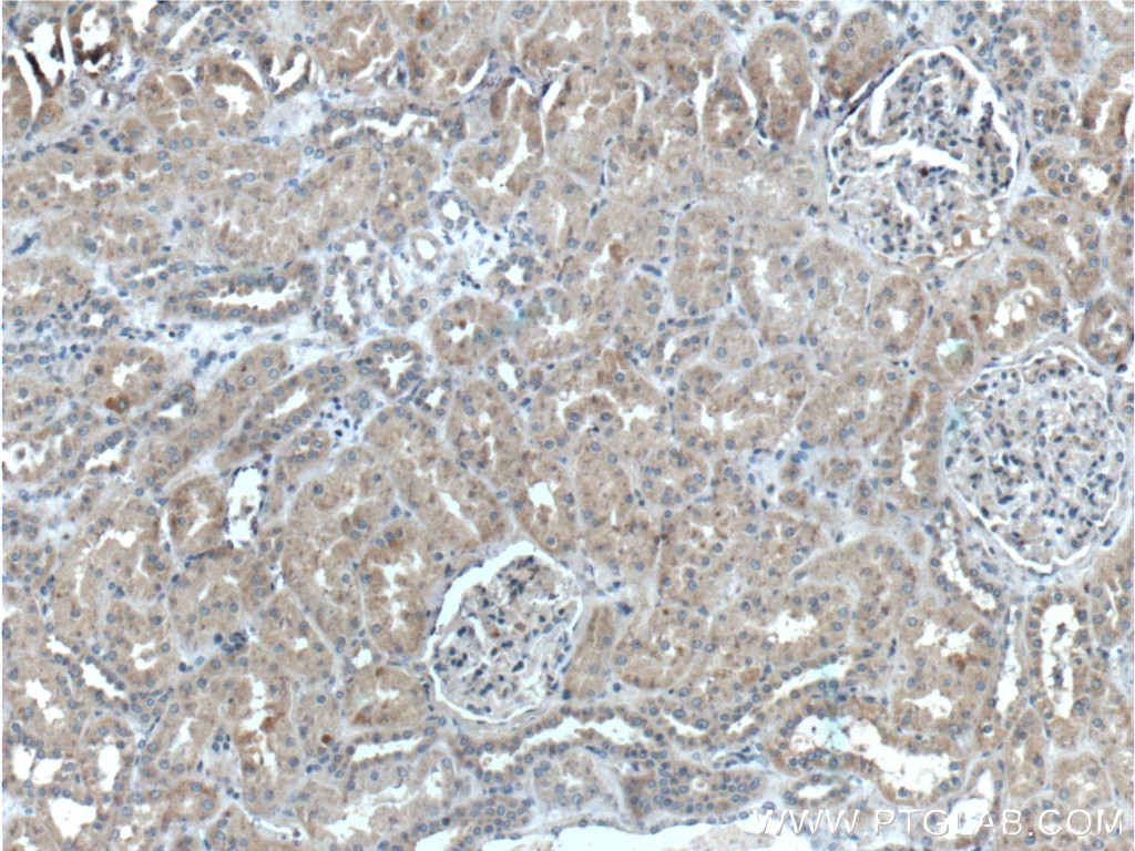 IHC staining of human kidney using 13778-1-AP