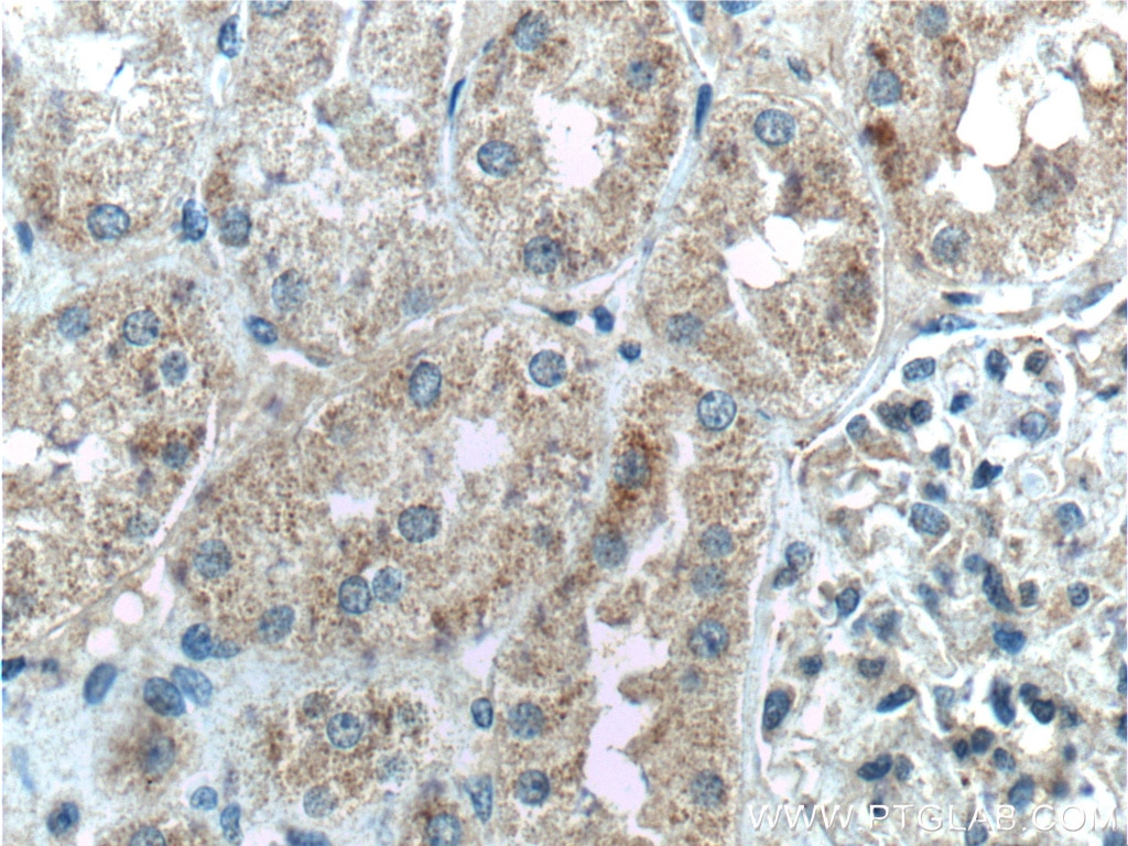 Immunohistochemistry (IHC) staining of human kidney tissue using TSLP Polyclonal antibody (13778-1-AP)