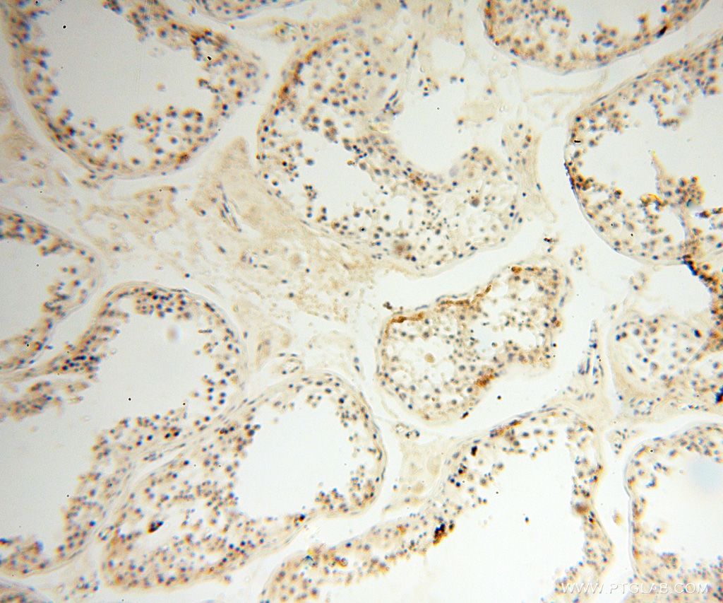 Immunohistochemistry (IHC) staining of human testis tissue using TSLP Polyclonal antibody (13778-1-AP)
