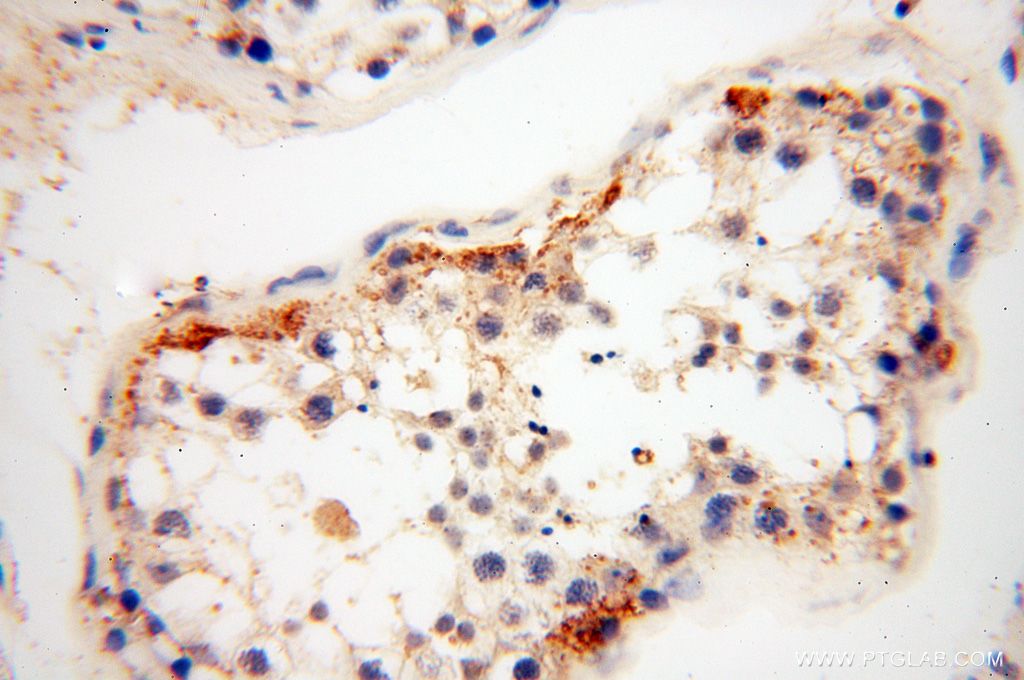 Immunohistochemistry (IHC) staining of human testis tissue using TSLP Polyclonal antibody (13778-1-AP)