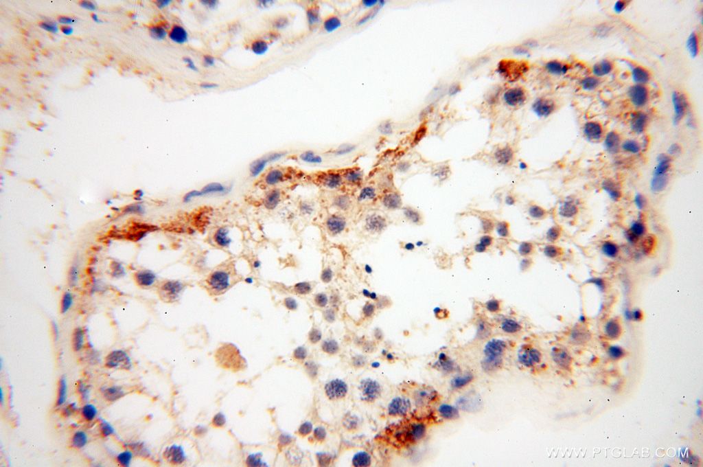 IHC staining of human testis using 13778-1-AP