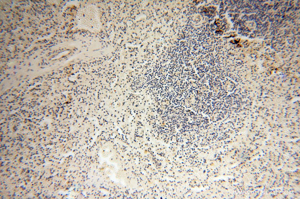 Immunohistochemistry (IHC) staining of human spleen tissue using TSLP Polyclonal antibody (13778-1-AP)