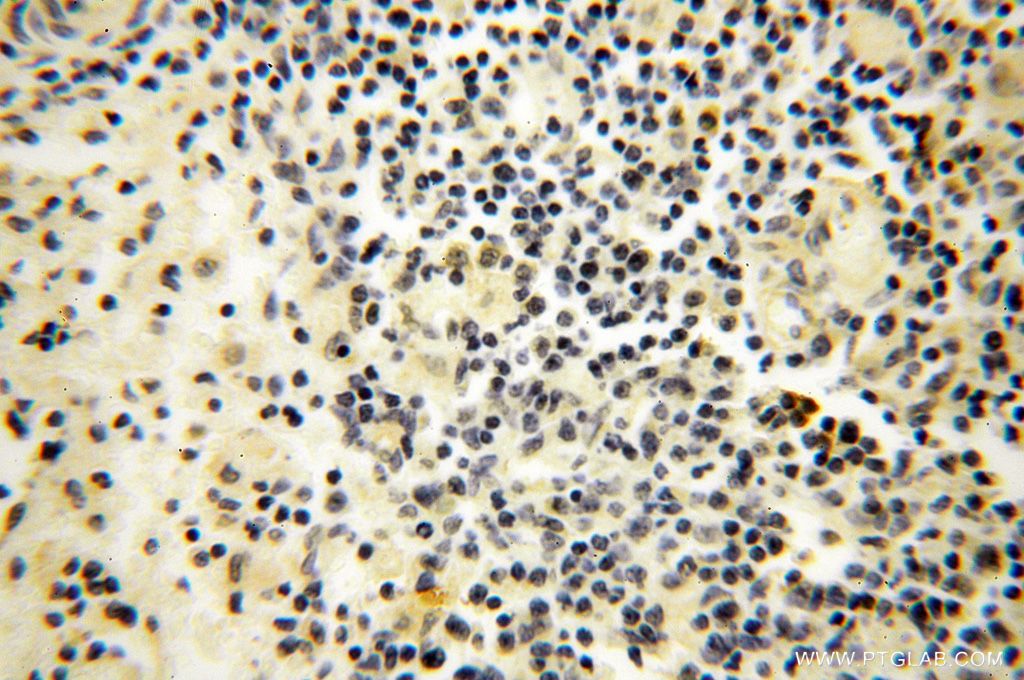 Immunohistochemistry (IHC) staining of human spleen tissue using TSLP Polyclonal antibody (13778-1-AP)