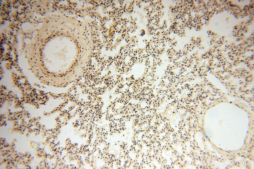 Immunohistochemistry (IHC) staining of human lung tissue using TSLP Polyclonal antibody (13778-1-AP)