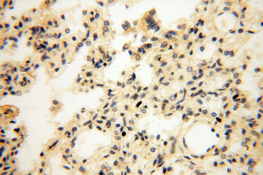 Immunohistochemistry (IHC) staining of human lung tissue using TSLP Polyclonal antibody (13778-1-AP)