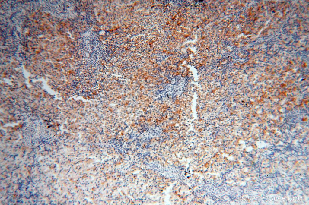 Immunohistochemistry (IHC) staining of human ovary tissue using TSLP Polyclonal antibody (13778-1-AP)