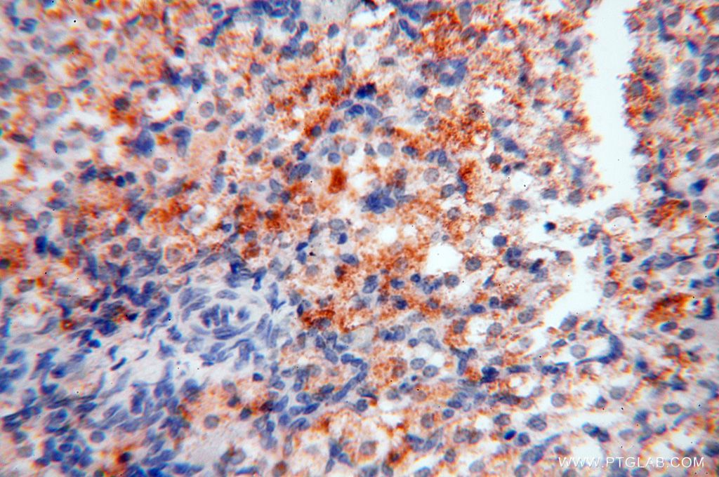 Immunohistochemistry (IHC) staining of human ovary tissue using TSLP Polyclonal antibody (13778-1-AP)