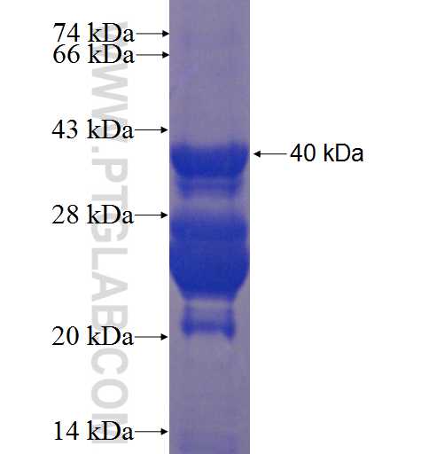 TSLP fusion protein Ag4756 SDS-PAGE