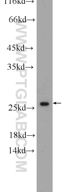 Western Blot (WB) analysis of Jurkat cells using TSN Polyclonal antibody (55426-1-AP)