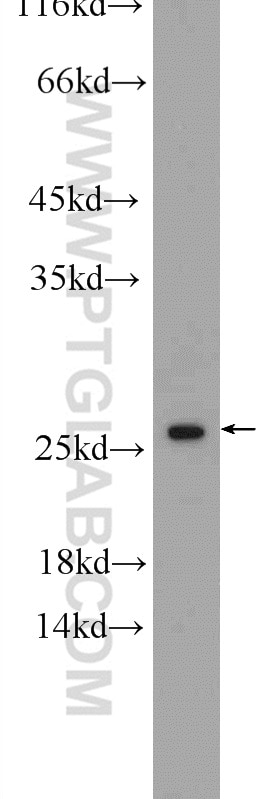 WB analysis of Jurkat using 55426-1-AP