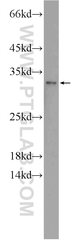 Western Blot (WB) analysis of HeLa cells using TSN Polyclonal antibody (55426-1-AP)